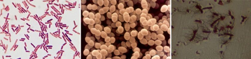 Escherichia coli, fekal enterokok ve Proteus, kronik bakteriyel prostatitin ana etken maddeleridir.