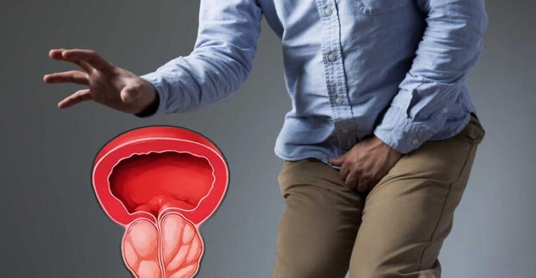 Prostatit ve prostat adenomunun önlenmesi